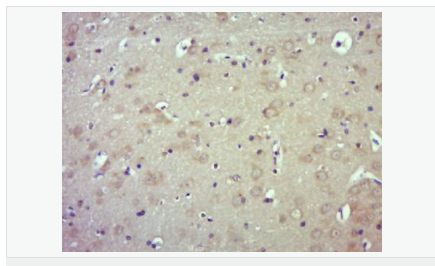 6052bad7a1fbe.png image.png