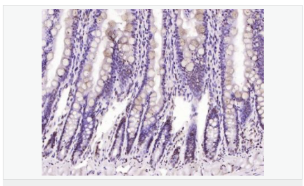 6052bc317e104.png image.png