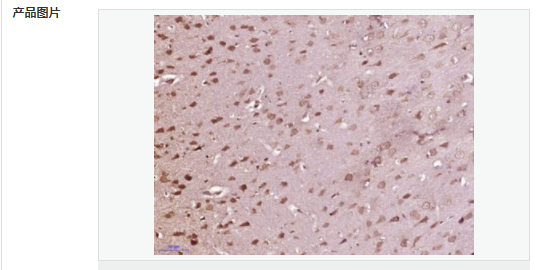 6052c09b9044d.png image.png