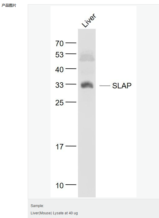 6057ef7e6051e.png image.png