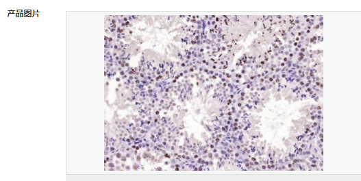 60595d32f419c.png image.png