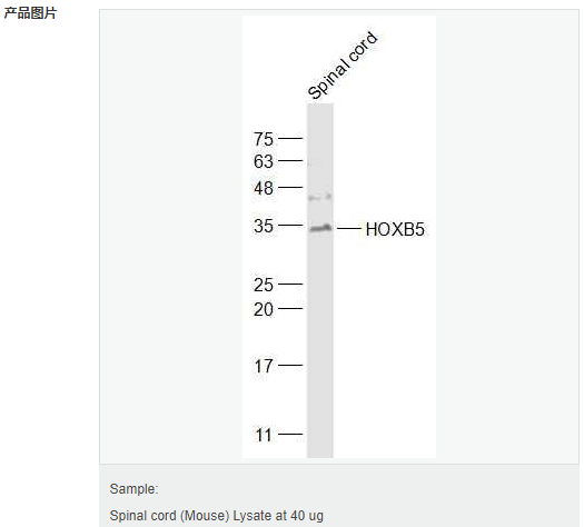 605acd786ea8e.png image.png