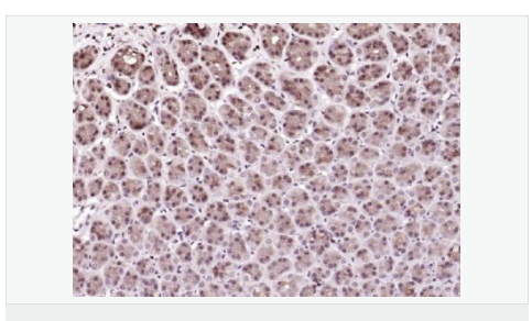 6066ba6095b4c.png image.png