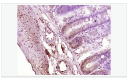 6066c6f854a8b.png image.png