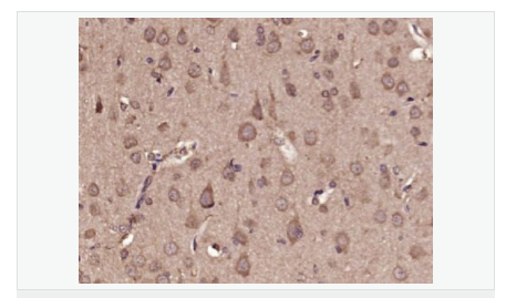 6066da756bbd8.png image.png