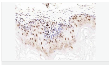 606bd47b5807d.png image.png