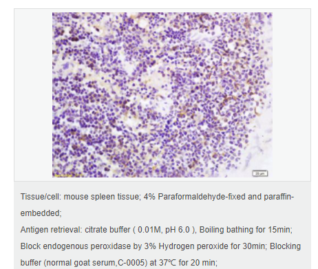 6076413c31f98.png image.png