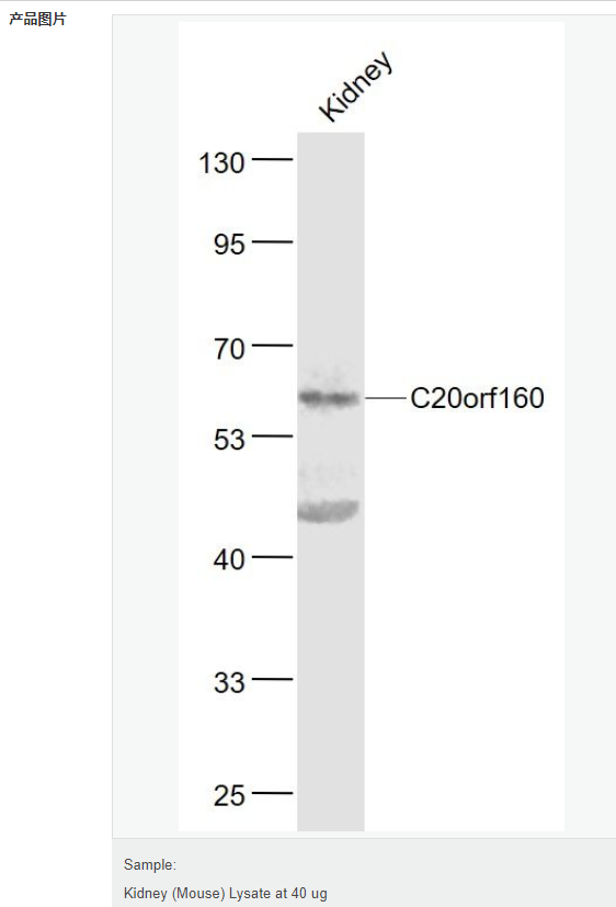 6076838f92b6e.png image.png