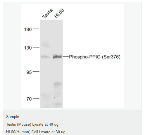 6077a9b45b5fd.png image.png