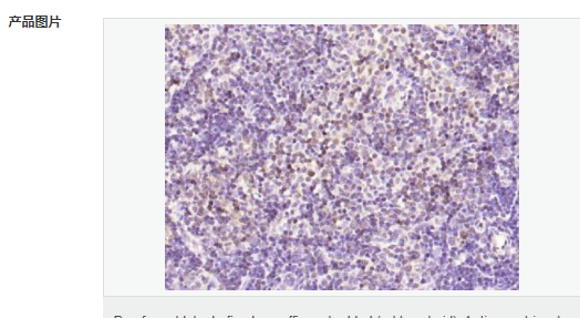 6079558b55631.png image.png